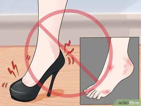 Image intitulée Prevent Foot Blisters Step 2