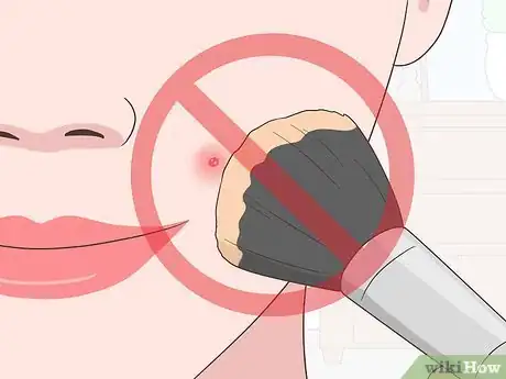 Image intitulée Stop a Pimple from Forming Step 4