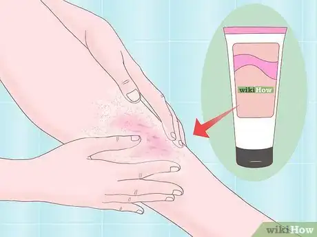 Image intitulée Deal with Thick Leg Hair Step 5