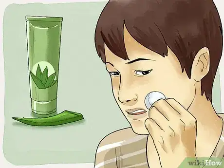 Image intitulée Get Rid of a Cold Sore with Home Remedies Step 10