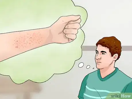 Image intitulée Treat Contact Dermatitis Step 11