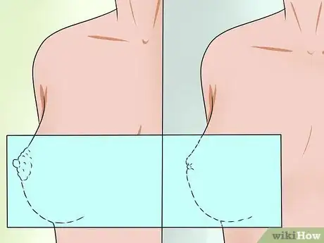 Image intitulée Know if You Have Breast Cancer Step 10