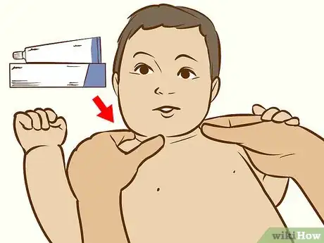 Image intitulée Treat Neck Rashes for Your Baby Step 3