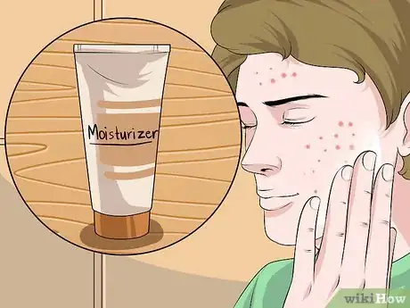 Image intitulée Dry Out a Pimple Step 11
