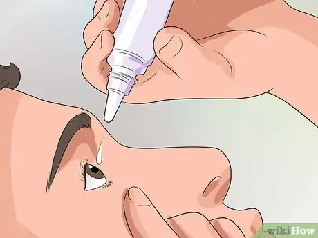 Image intitulée Get Rid of Pink Eye Fast Step 5