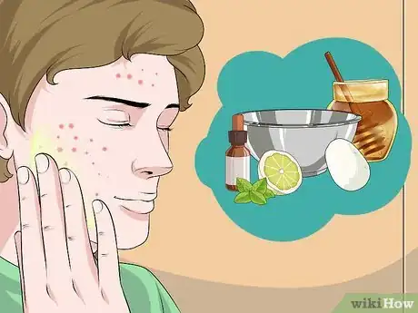 Image intitulée Dry Out a Pimple Step 10