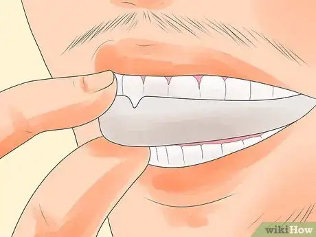 Image intitulée Cure Bruxism Step 13