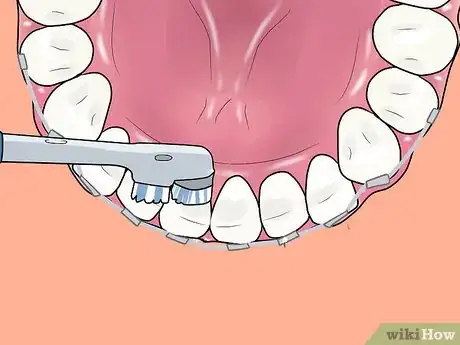 Image intitulée Use an Electric Toothbrush with Braces Step 11