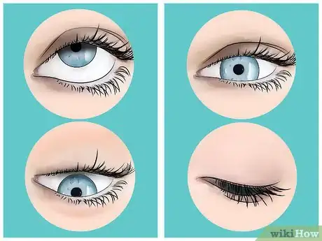 Image intitulée Get Rid of Eye Floaters Step 5