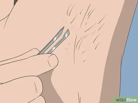 Image intitulée Reduce Body Hair Growth Step 13