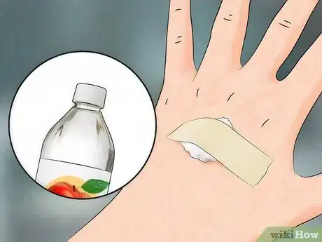 Image intitulée Reduce the Pain of Gnat Bites Step 3