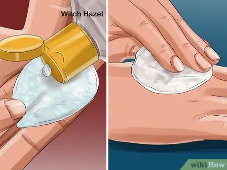 Image intitulée Apply Witch Hazel to Your Face Step 11