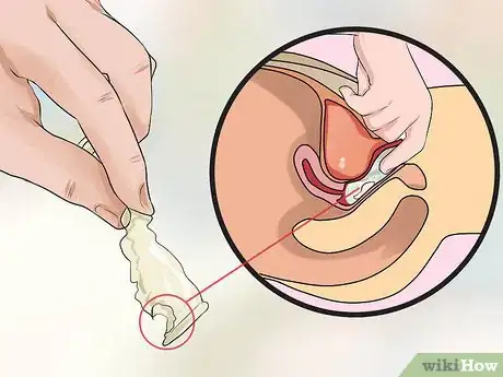 Image intitulée Remove a Condom Stuck Inside Step 5