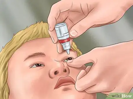 Image intitulée Administer Eye Drops in Children Step 24