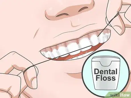 Image intitulée Reduce Gum Swelling Step 11