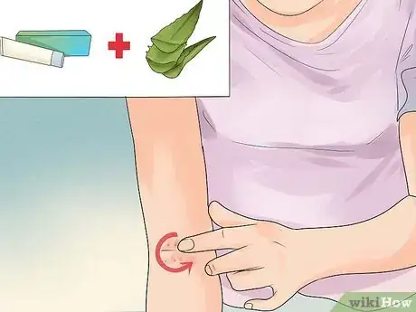 Image intitulée Treat Eczema Naturally Step 9