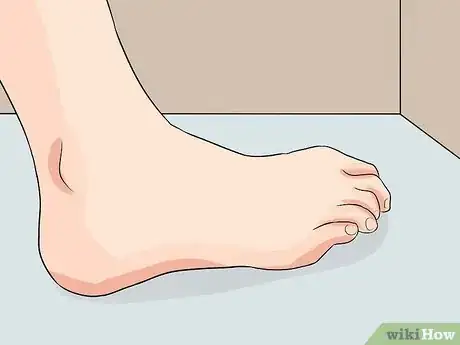 Image intitulée Identify Achilles Tendinitis Step 4