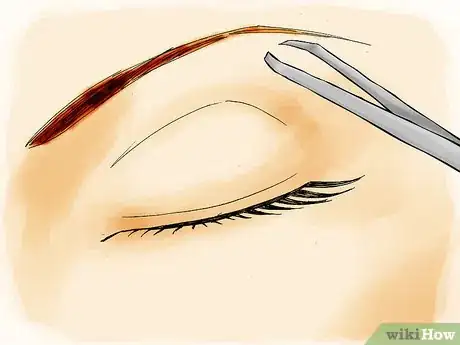 Image intitulée Prevent Ingrown Facial Hair Step 14