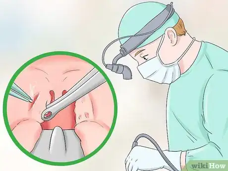 Image intitulée Stop Snoring Step 17