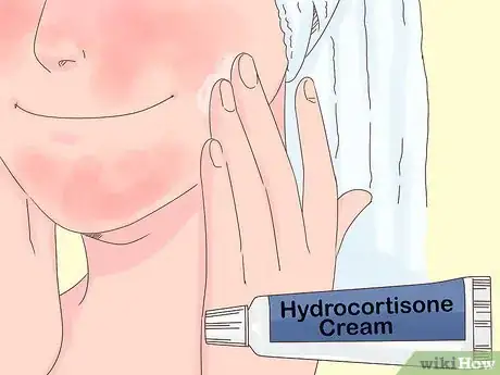 Image intitulée Treat Face Eczema Step 8