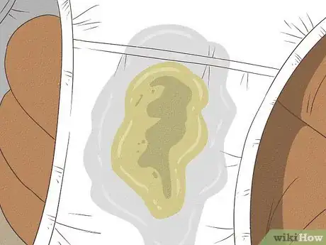 Image intitulée Get Rid of Vaginal Odor Fast Step 11