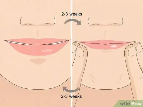 Image intitulée Get Rid of Jowls Step 3