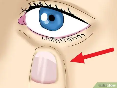 Image intitulée Take Out Contact Lenses Without Touching Your Eye Step 7