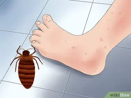 Image intitulée Treat Insect Bites in Toddlers Step 13