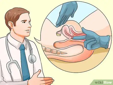 Image intitulée Have a Gynecological Exam Step 20