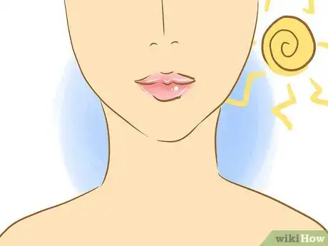 Image intitulée Stop Picking Your Lips Step 13