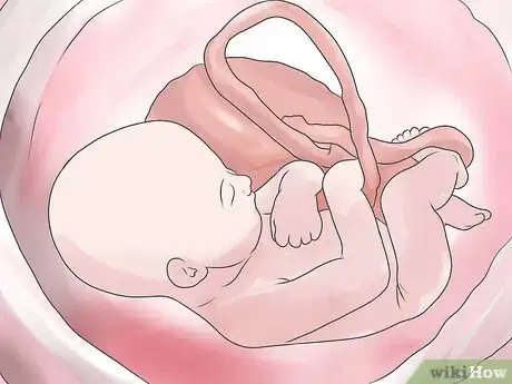 Image intitulée Prepare for a Cesarean Section Step 18