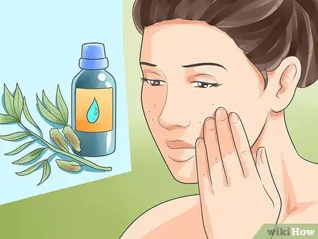 Image intitulée Use Household Pantry and Bathroom Items to Remove Acne Step 3