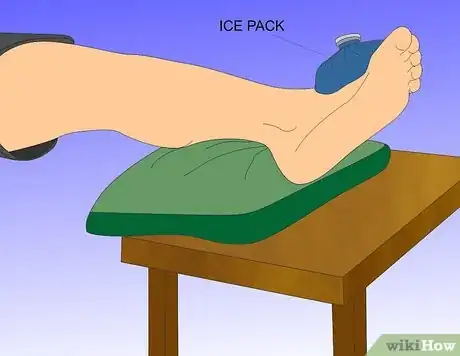 Image intitulée Treat a Foot Stress Fracture Step 3