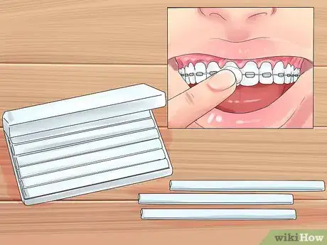 Image intitulée Alleviate Orthodontic Brace Pain Step 10