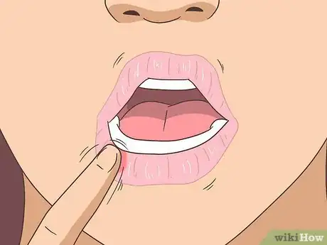 Image intitulée Get Rid of Numbness in Your Lip Step 4