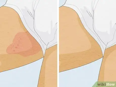 Image intitulée Prevent Chafing Step 16