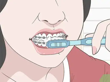 Image intitulée Eat Food With New or Tightened Braces Step 11