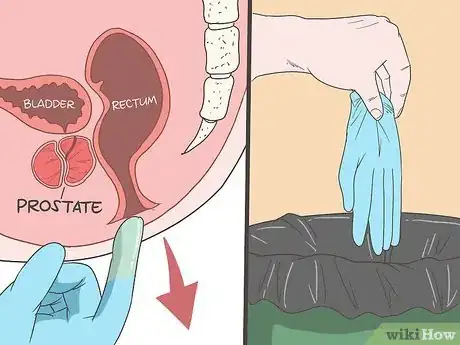 Image intitulée Locate Your Prostate Step 10