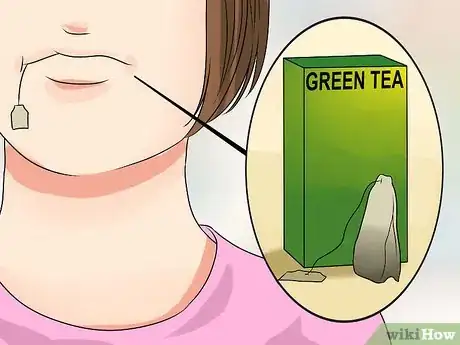 Image intitulée Stop Wisdom Tooth Pain Step 11