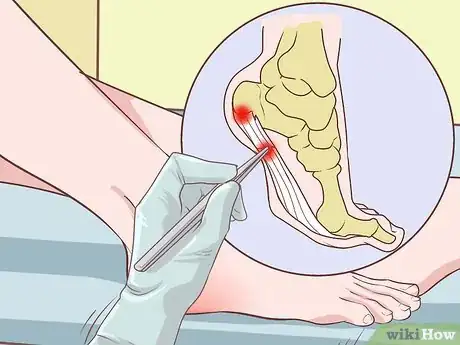 Image intitulée Relieve Plantar Fasciitis Pain Step 13