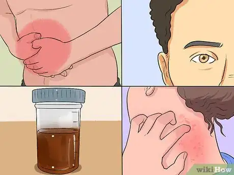 Image intitulée Repair Liver Damage Step 11