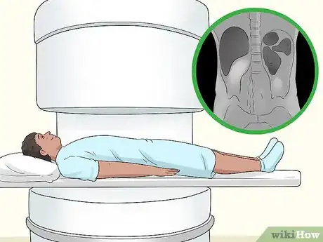 Image intitulée Distinguish Between Kidney Pain and Back Pain Step 10