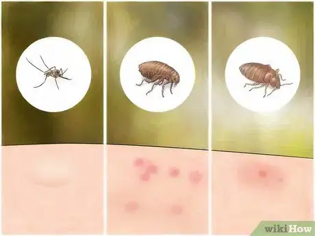 Image intitulée Identify Insect Bites Step 2