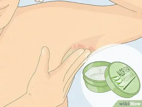 Image intitulée Prevent Chafing Step 15