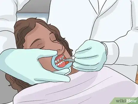 Image intitulée Prepare on the Day You Get Braces Step 11