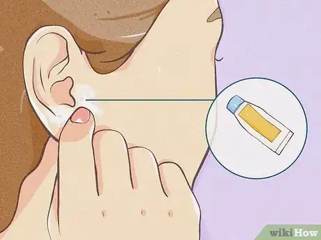 Image intitulée Gauge Your Ears Step 12