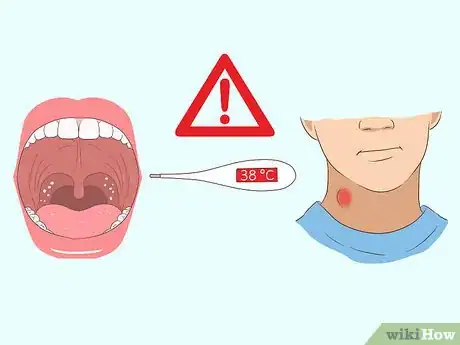 Image intitulée Numb a Sore Throat Step 9