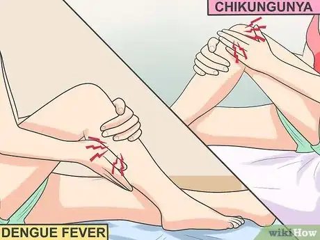 Image intitulée Ease Muscle Pain from Chikungunya Step 3
