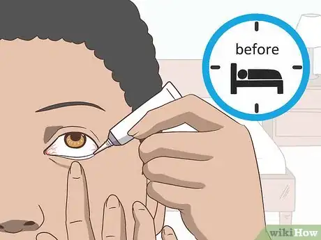 Image intitulée Get Rid of Itchy Eyes Step 13