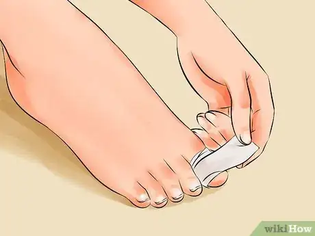 Image intitulée Remove an Ingrown Toenail Step 17